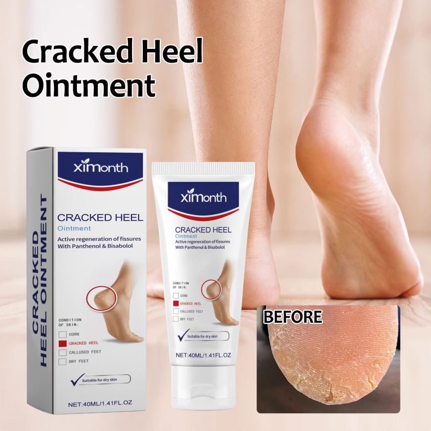 Unguent pentru calcaie crapate, reparare si hidratare, Ximonth 40 ml